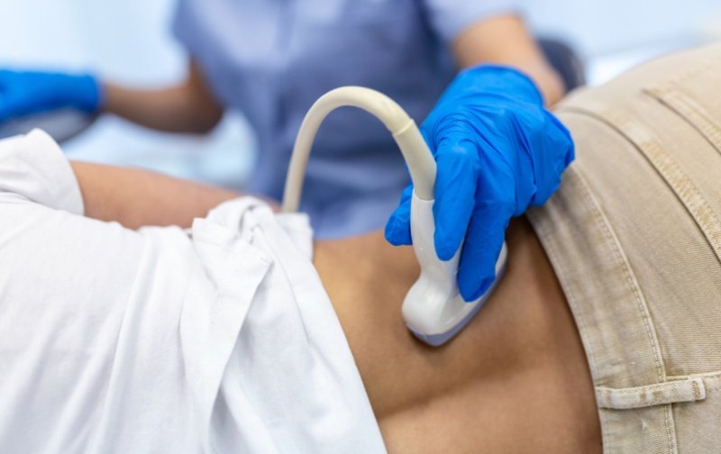 Cicatrices con Indiba