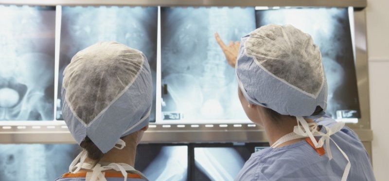 Operaci�n de la hernia discal