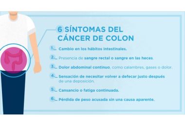 Los seis sntomas que nos alertan de la posibilidad de padecer un cncer de colon